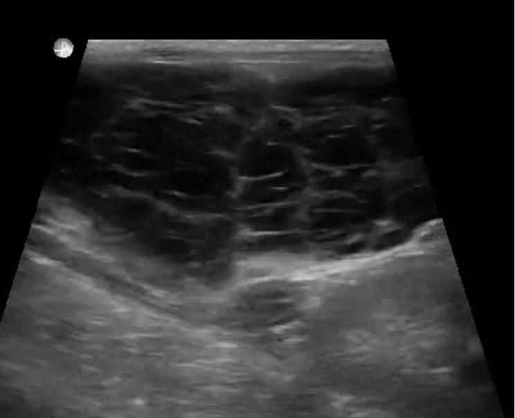 Ultrasound Characteristics of Canine Pancreatitis